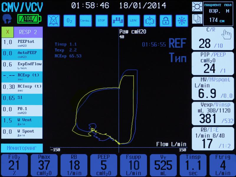 INTENSIVE CARE VENTILATORS